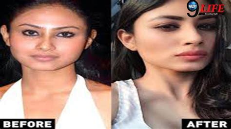Mouni Roy Transformation Before And After Surgery Youtube