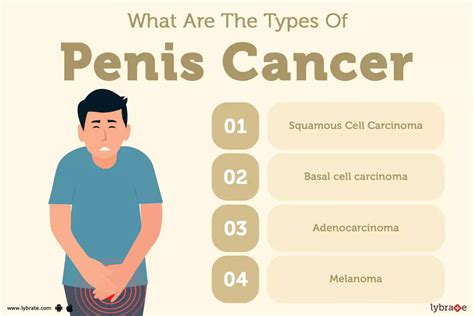 Penis Cancer Causes Symptoms Treatment And Cost