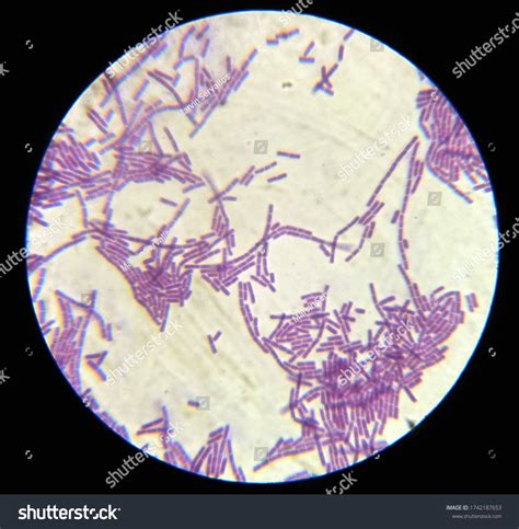 Streptobacillus Bacteria Seen Under High Power Stock Photo 1742187653