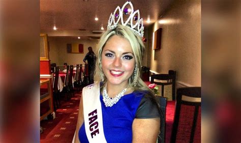 Beauty Queen Who Suffered A Stroke When She Was Shares Her First