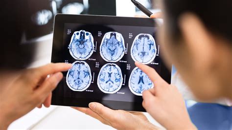 Brain Imaging Techniques Types And Uses Psych Central