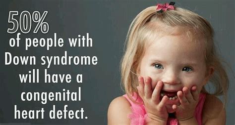 The Association Of Congenital Heart Defects And Down Syndrome Blog