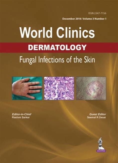 World Clinics Dermatology Fungal Infections Of The Skin