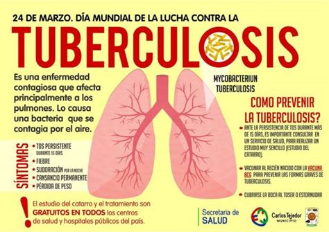 Drpablo Perachia Hay Un Caso De Tuberculosis Diagnosticado Y