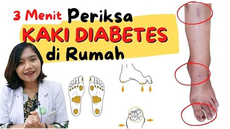 3 Menit Periksa Kaki Diabetes Di Rumah Dremasuperr Youtube