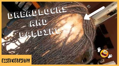 Dreadlocks And Balding Causes And Preventions I Essenceofshay Youtube