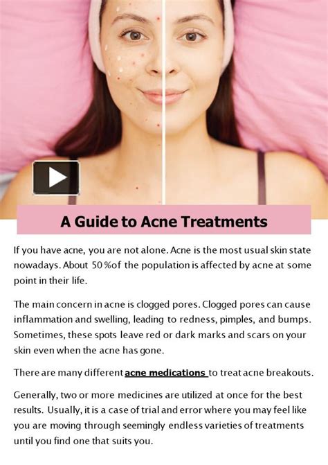 Ppt A Guide To Acne Treatments Powerpoint Presentation Free To
