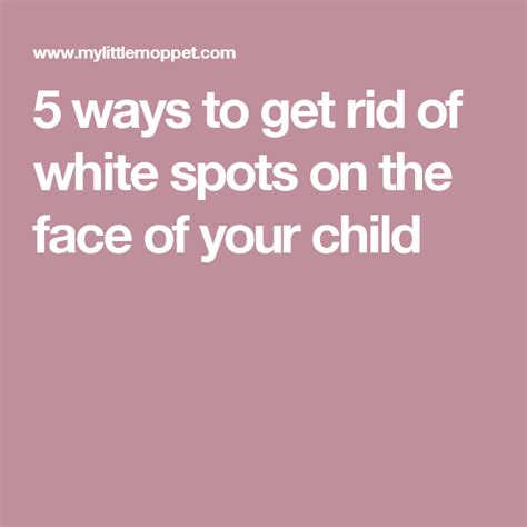 5 Ways To Get Rid Of White Spots On The Face Of Your Child Face How