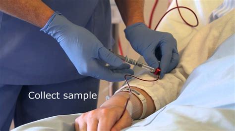 Collecting An Arterial Line Sample Youtube