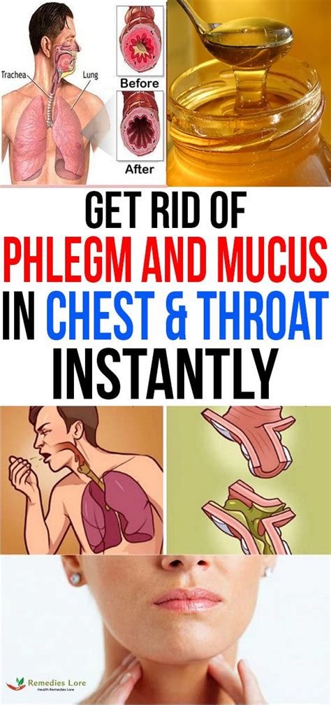 Get Rid Of Phlegm And Mucus In Chest And Throat Instantly Getting Rid