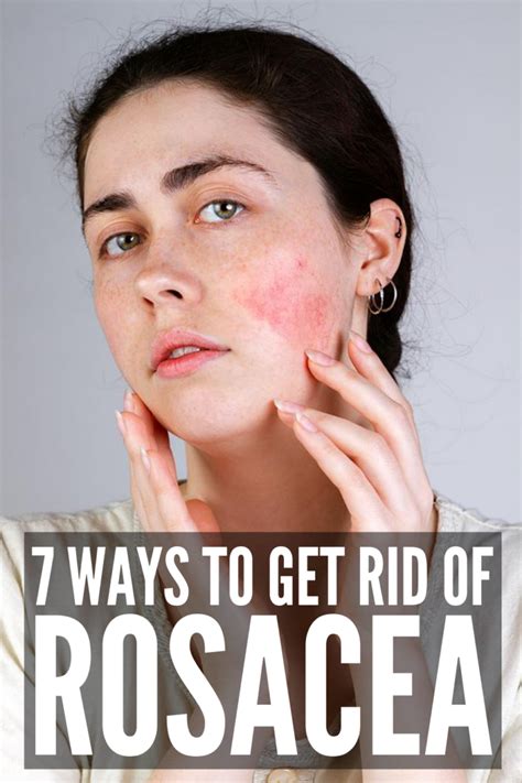 How To Get Rid Of Rosacea 7 Rosacea Remedies That Work