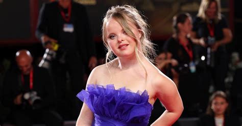 Breaking Barriers Model With Down Syndrome Makes Catwalk Debut At