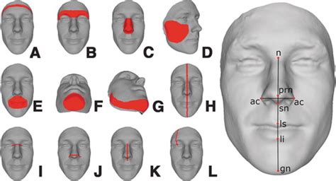 sex differences in adult facial three dimensional morphology application to gender affirming