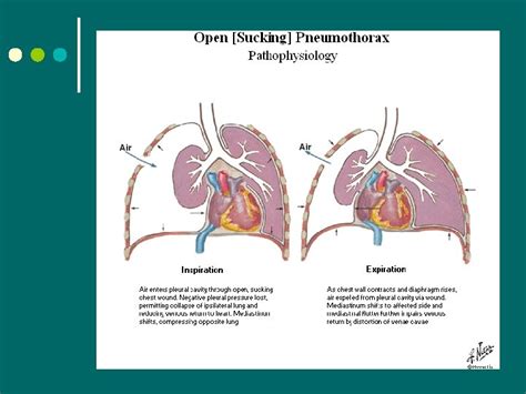 Thorax And Lungs By Orest Kornetsky Anterior Thorax