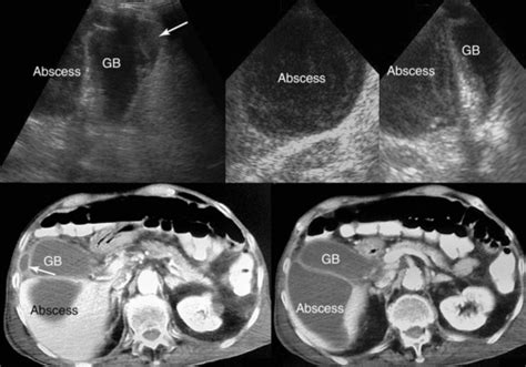 Various Targets In The Abdomen Hepatobiliary System Spleen Pancreas