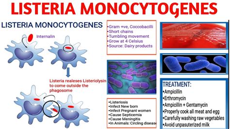Listeria Monocytogenes Pathogenicity Listeriosis Diagnosis