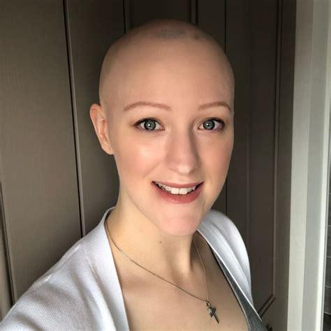 Bride With Alopecia Gets Confidence Boost Thanks To £2500 Wig Essex Live