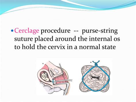 Ppt Complications Of Pregnancy Powerpoint Presentation Free Download