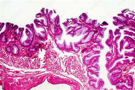 Transitional Epithelium Tissue Of The Urinary Bladder Under Microscope