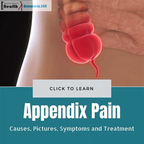 Table 1, examples of vaccine classes and associated industrial challenges; Appendix Pain : Causes, Pictures, Symptoms and Treatment