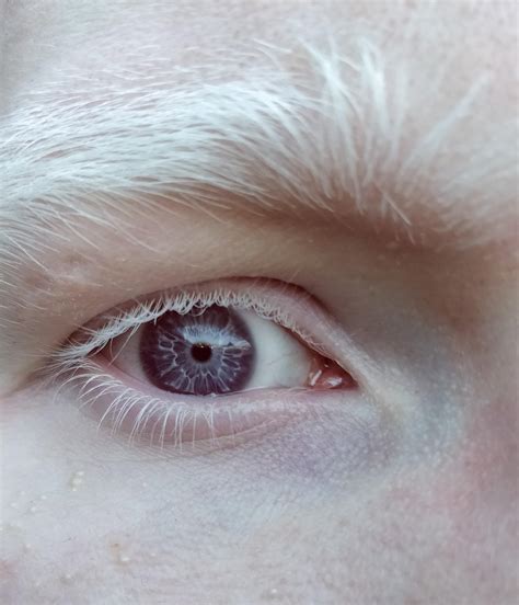 I Have Purple Eyes Rmildlyinteresting