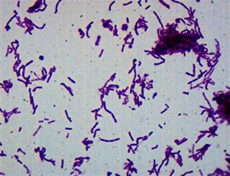 Buy Bacillus Smear Gram Negative Stain Prepared Micro Slide 75 X