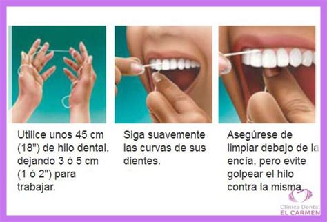 Clínica Dental El Carmen ¿cuál Es El Modo Correcto De