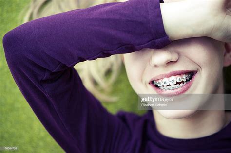 Girl With Braces Laughing While Covering Eyes Photo Getty Images