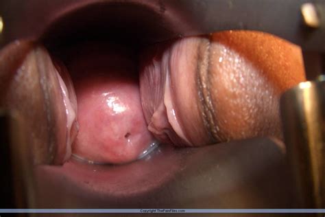 Medical Pictures Clitoris