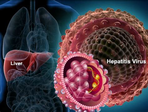 Hepatitis b is an infection of your liver. Hepatitis B - Crohn's Disease Living Probiotics