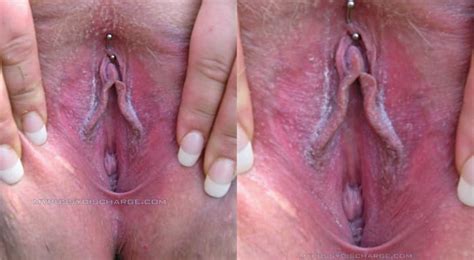 Dirty Pussy With Cheesy Smegma Around Small Labia My Pussy Discharge