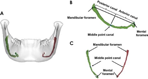 A Three­dimensional 3d Model Of The Mandible Including The Right