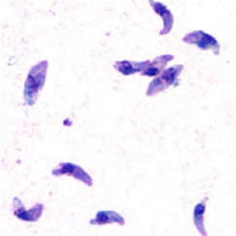 Infectious Disease Infective Parasitic Pathogen Toxoplasma Gondii