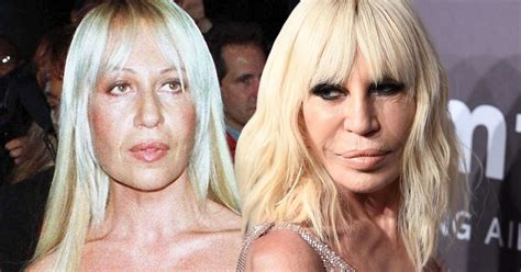 What Happened To Donatella Versace S Face Flipboard