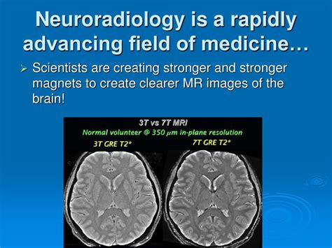 Ppt Neuroradiology Powerpoint Presentation Free Download Id23267