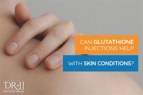 Can Glutathione Injections Help You With Skin Conditions Dr Jj