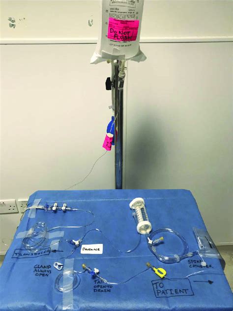 Example Of Cerebrospinal Fluid Drainage System Set Up The System Is