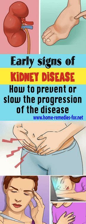 Early Signs Of Kidney Disease And How To Prevent Or Slow The
