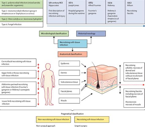 Necrotising Soft Tissue Infections The Lancet Infectious Diseases