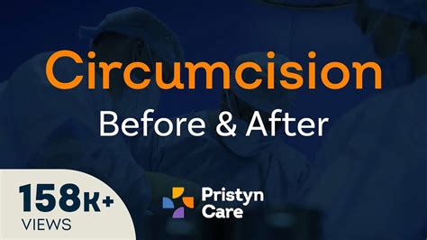 before v s after laser circumcision surgery oasis medical aesthetics