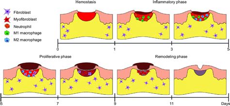 Schematic Representation Of The Different Wound Heali