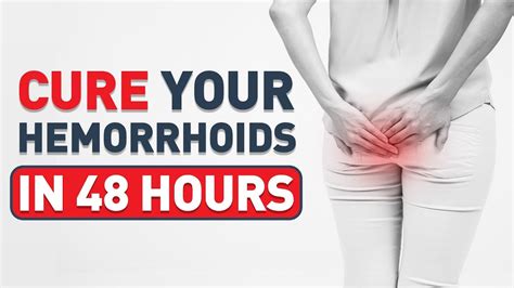 Treatments For Hemorrhoids HOW TO Shrink Hemorrhoids FAST And Naturally Treatments For