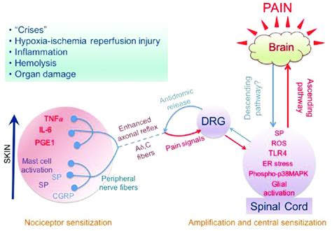 Sickle Pathobiology Evoked Peripheral And Central Mechanisms Of Pain