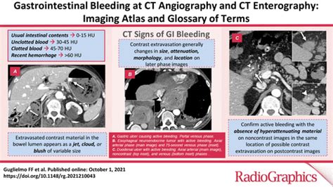 Gastrointestinal Bleeding At Ct Angiography And Ct Enterography