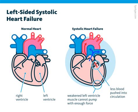 Cardiac Lipid Metabolism In Heart Failure Lipidomics Of Tissue And
