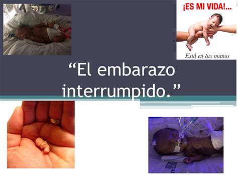 Imagenes De Embarazo Interrumpido Manual De Instrucciones El Embarazo Con Ilustraciones De