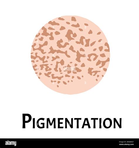 Pigmentation On The Skin A Pigmented Spot On The Skin Of The Face