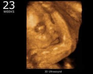 Memasuki usia kehamilan 6 minggu organ tubuh janin berkembang dan membesar. Hamil 23 Minggu dan 4 Pertanyaan yang Sering Diajukan ke ...