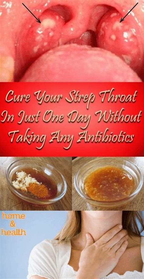Antibiotics For Strep