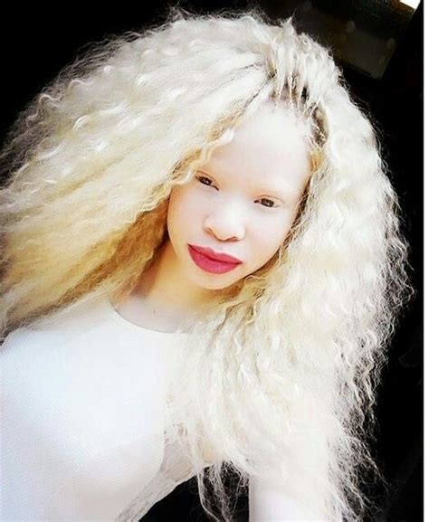Albino Girl Modelo Albino Black Is Beautiful Most Beautiful Women